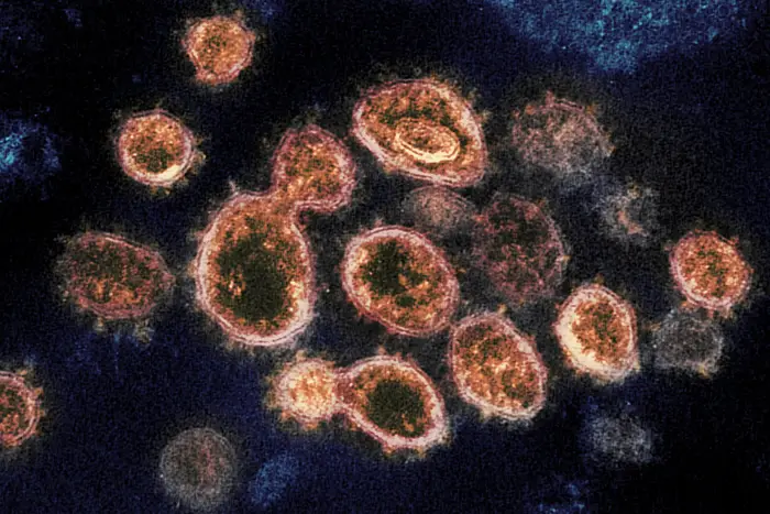 Microscope image of the COVID-19 virus, showing blobs of cells with spikes on them.